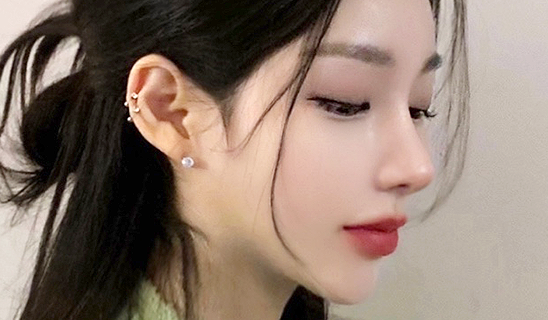 Rhinoplasty